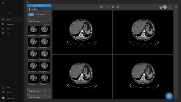 OmegaAI radiology PACS viewer interface screenshot
