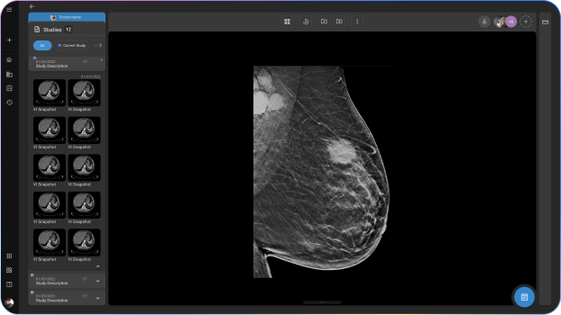 OmegaAI mammography pacs image viewer software interface screenshot
