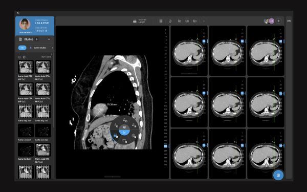PACS emr integration interface