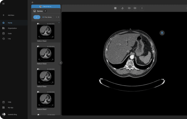 view-oncology-images-reports-1-598x382.png