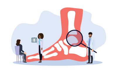 Illustration of healthcare professionals examining a foot x-ray