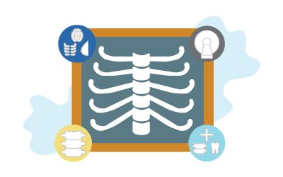 Chest xray with automation icons