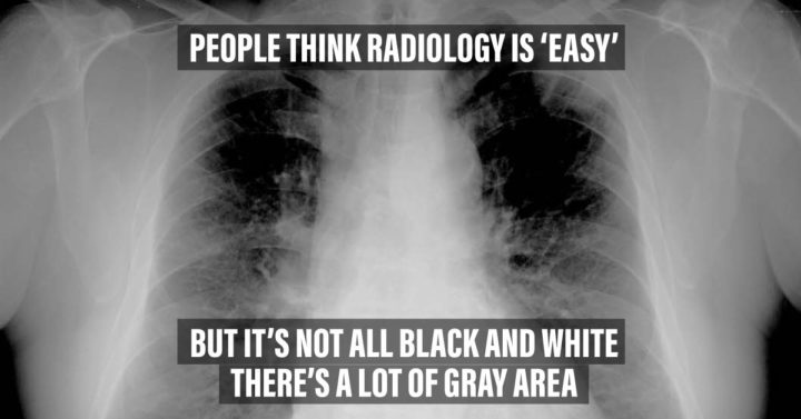 chest x ray funny meme