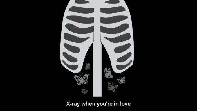 x ray joke when you are in love