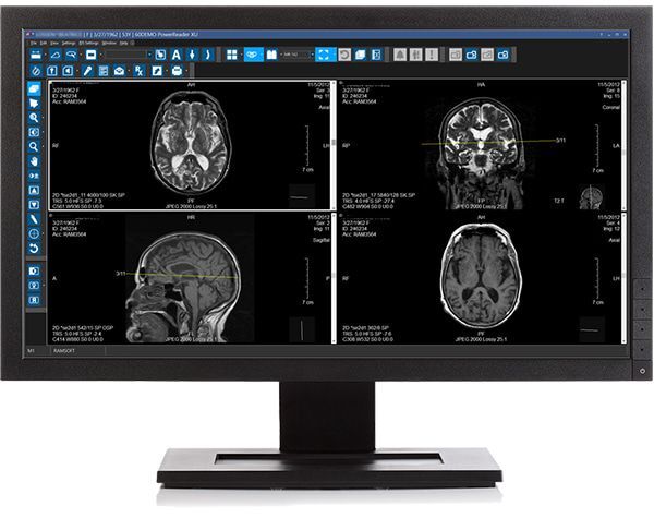 pacs system for radiology