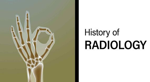 History of Radiology: Timeline, Pioneers, Inventions