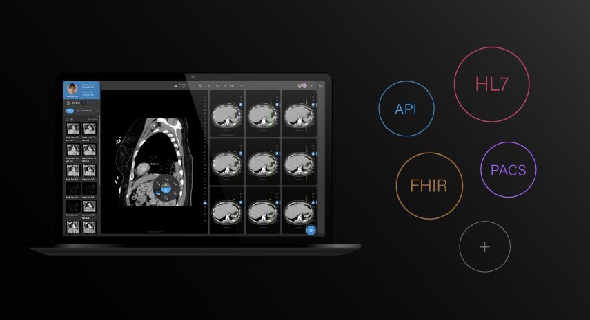 EMR Integration: Facts, Benefits, Challenges, & Strategies