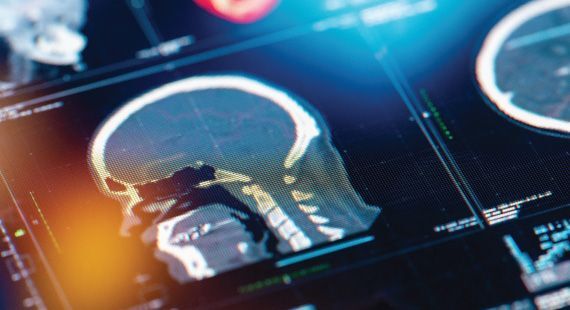 Game-Changing X-ray Innovations in Medical Imaging