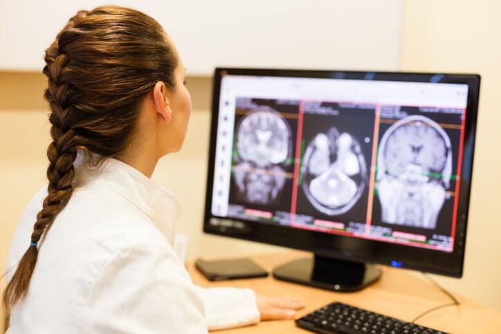 Female radiologist reviewing brain MRI scans on a computer monitor using PACS imaging system and RIS software in a medical office.