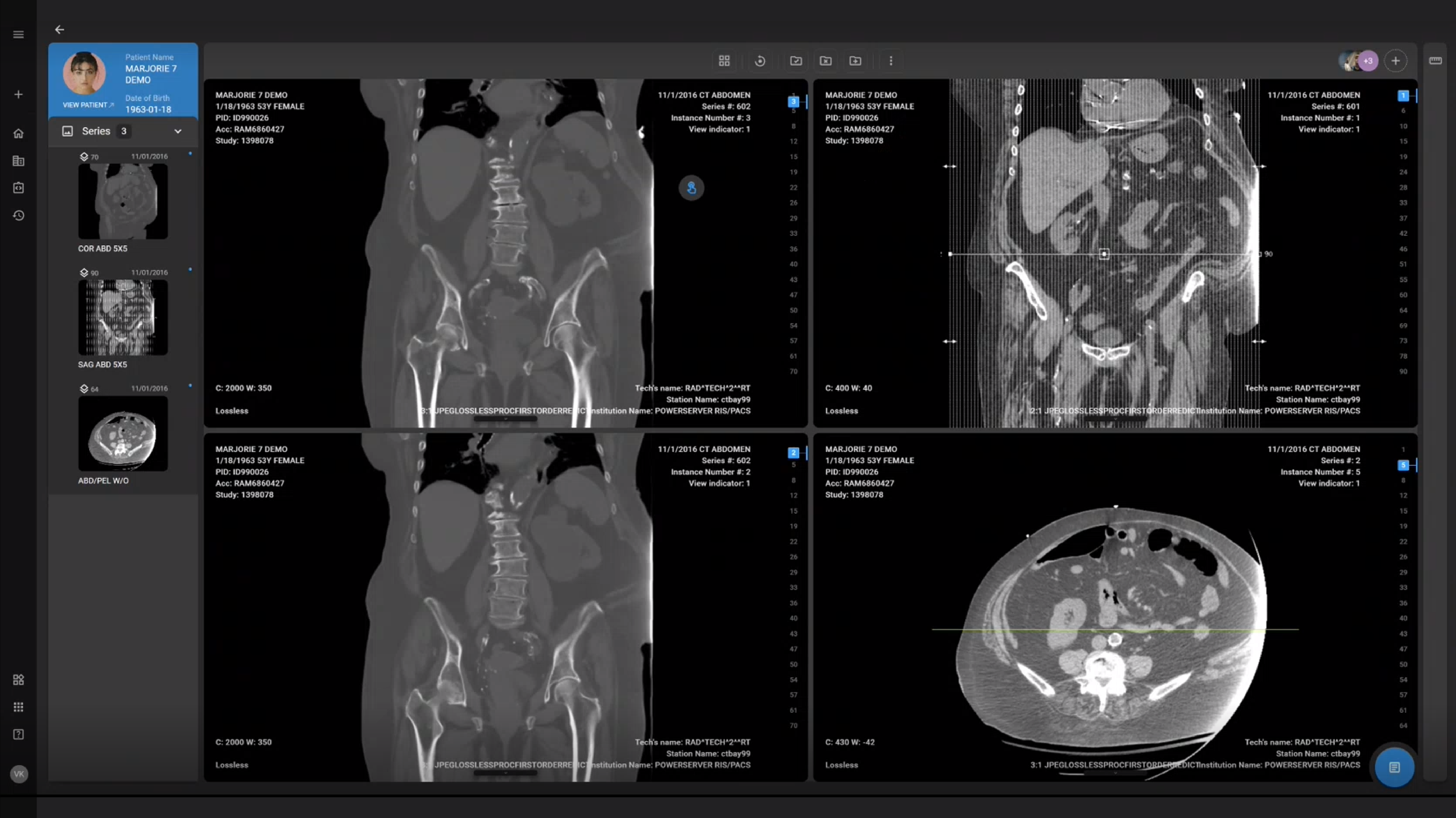 Advancements in PACS Radiology Software