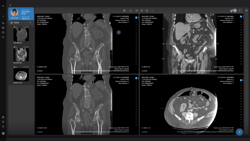 Radiology software RIS (Radiology Information System) interface for healthcare professionals.