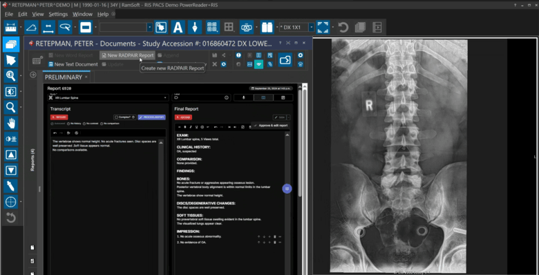 Radiology information system report generation interface