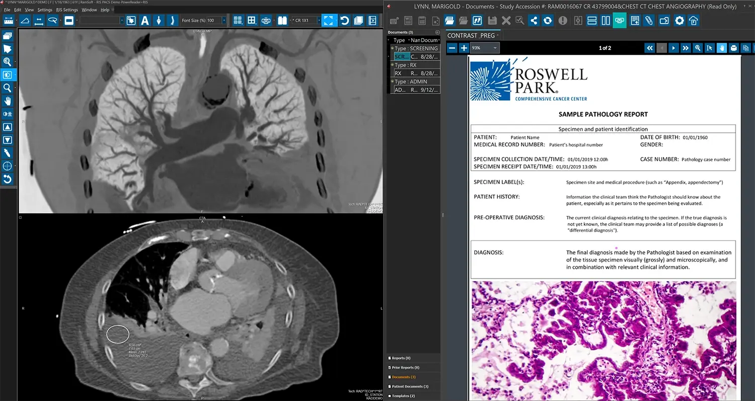 Revolutionizing Medical Practices with Cutting-Edge PACS XRay Systems