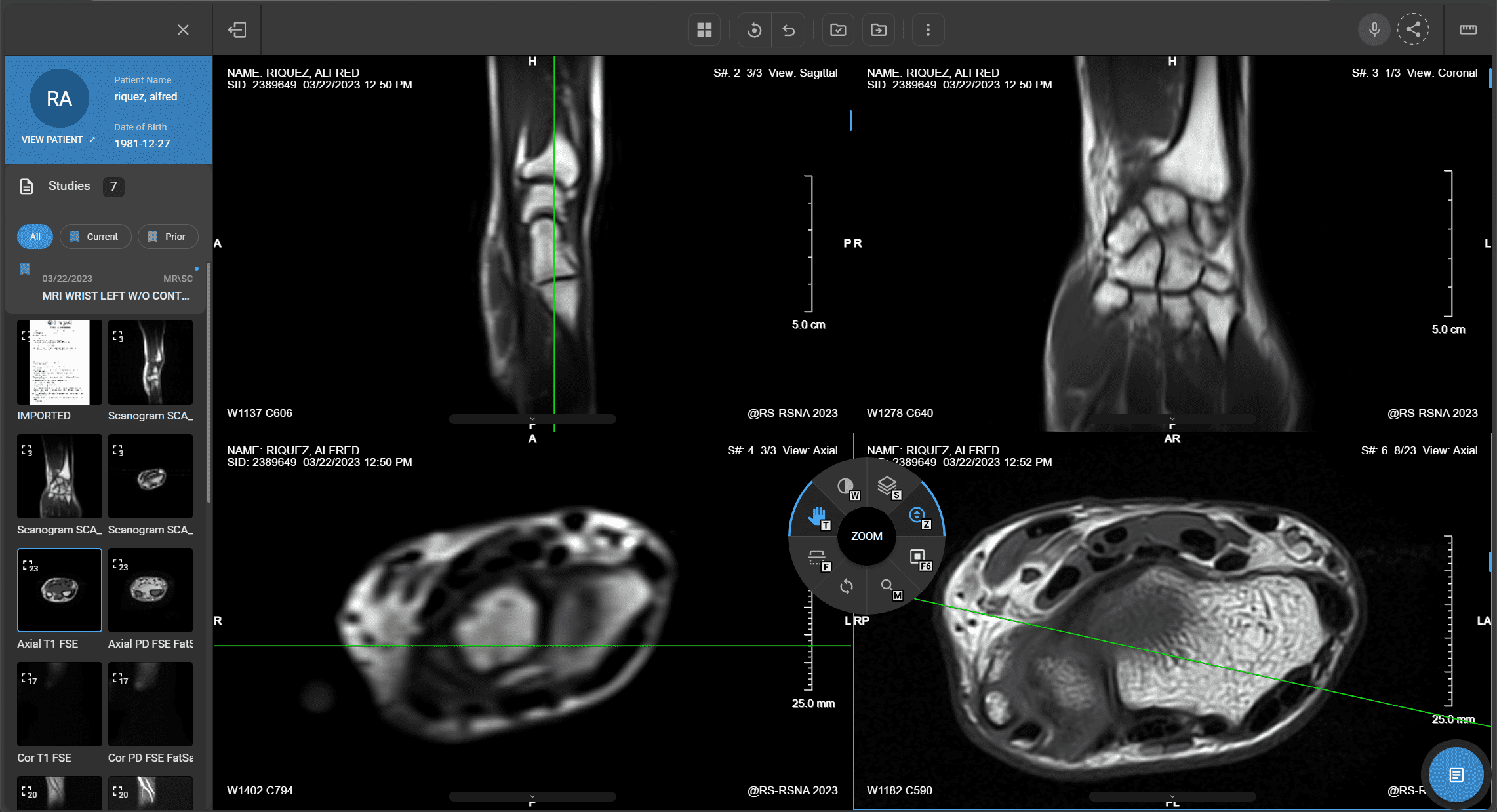 PACS system advanced viewing tools screenshot 