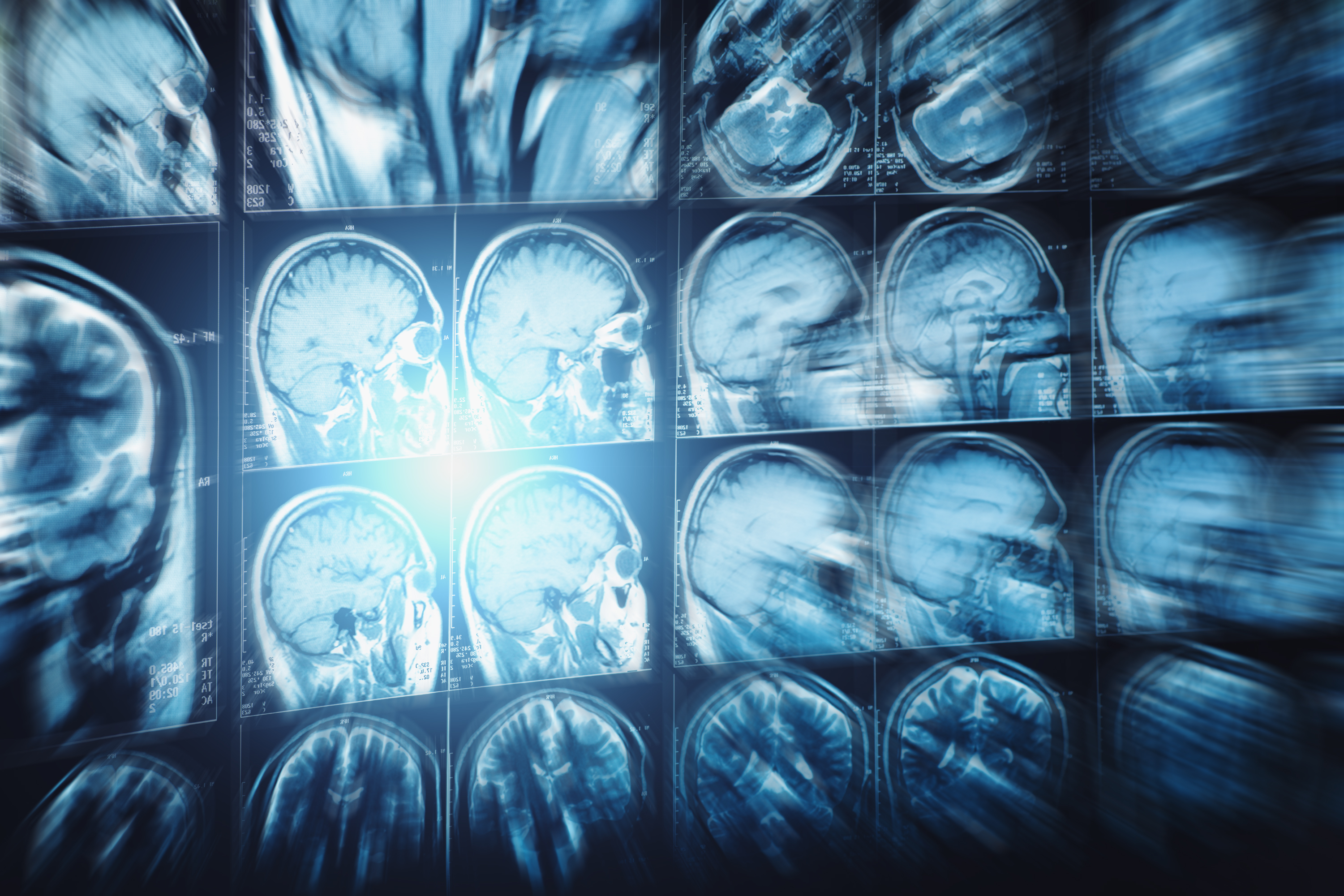 Quicker Radiological Reporting